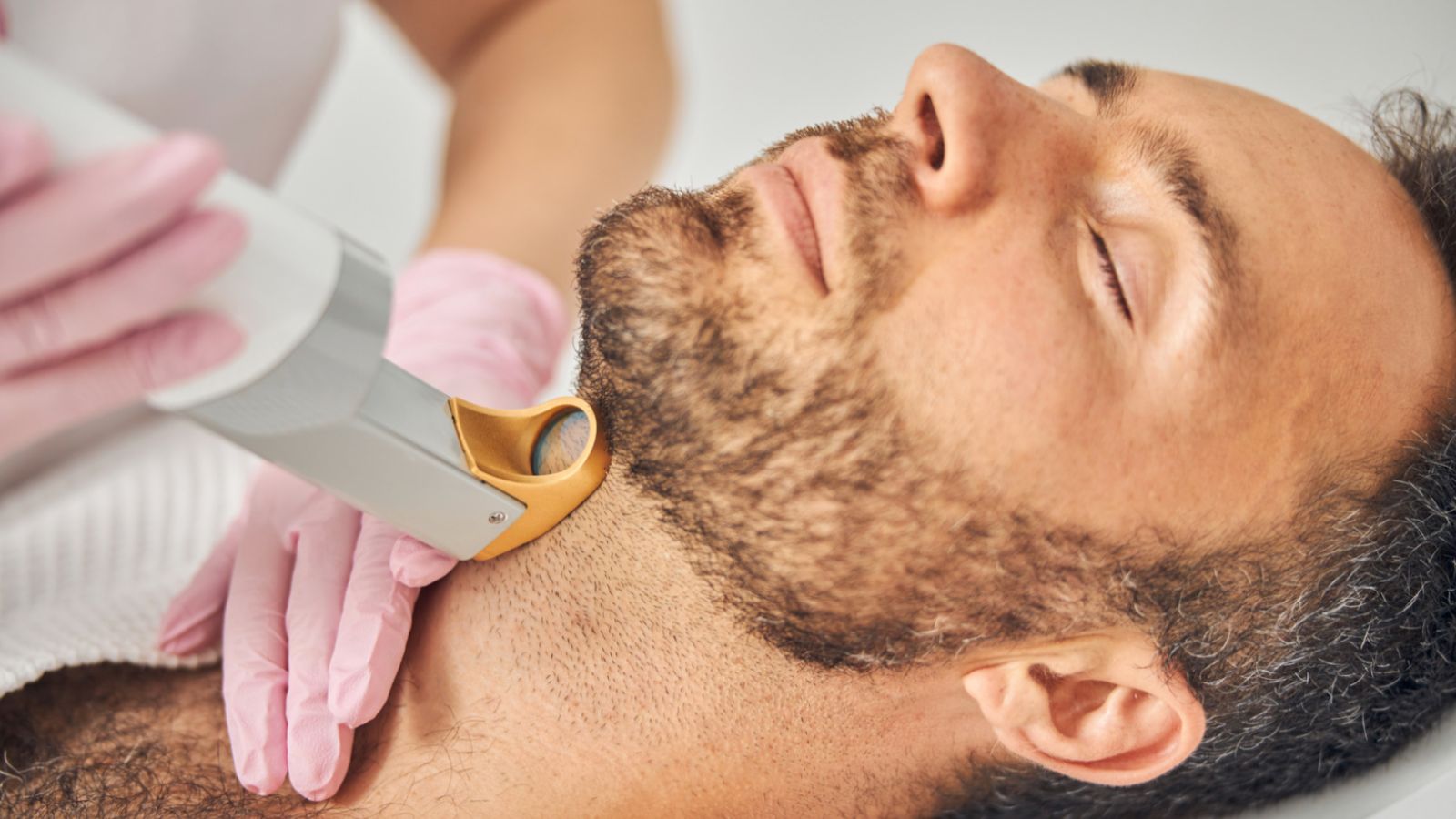 لیزر موی زائد و سرطان پوست