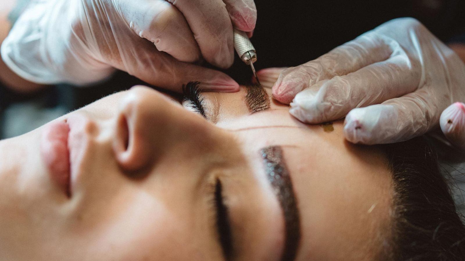 میکروبلیدینگ