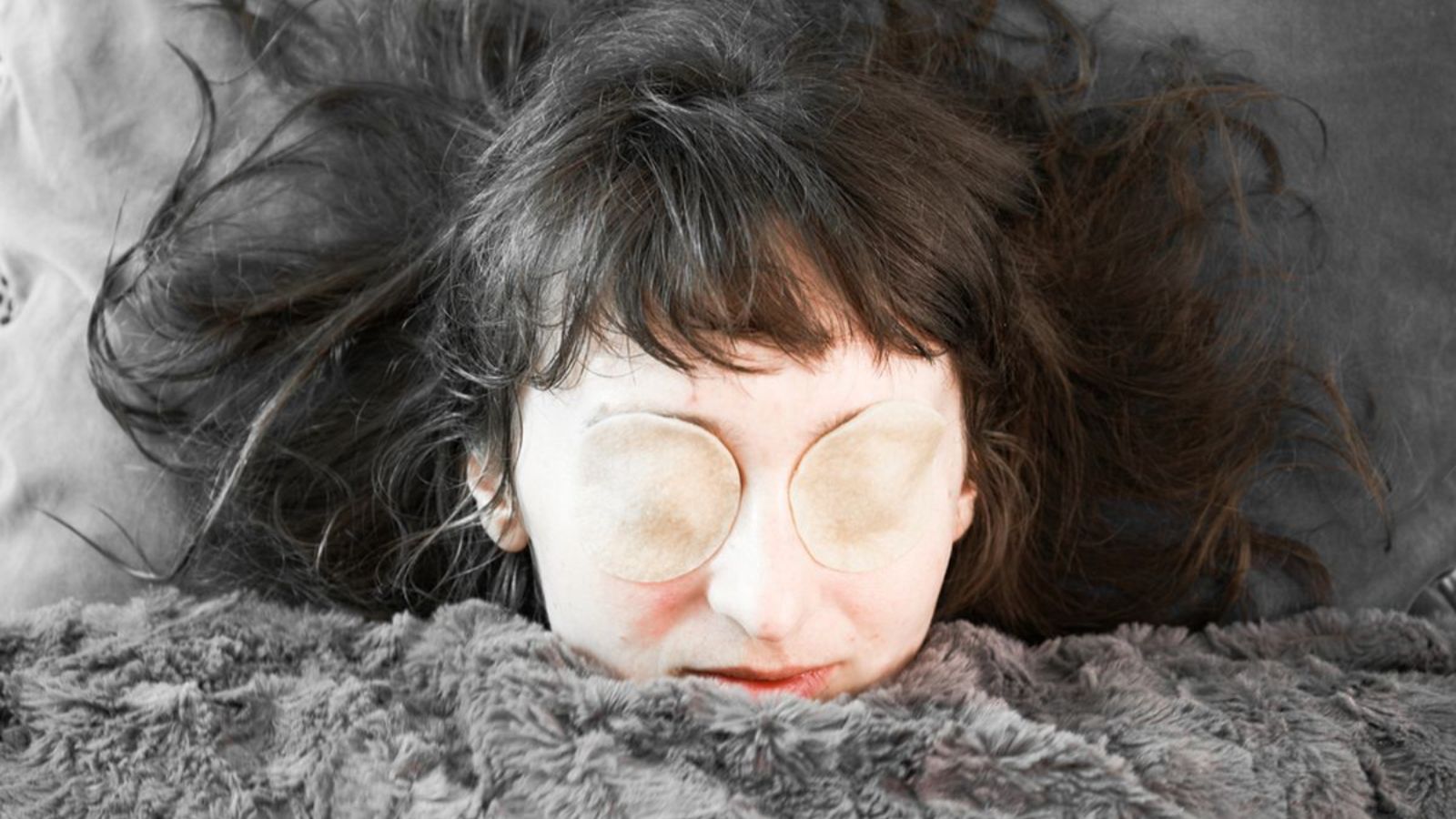 سندروم زیبای خفته