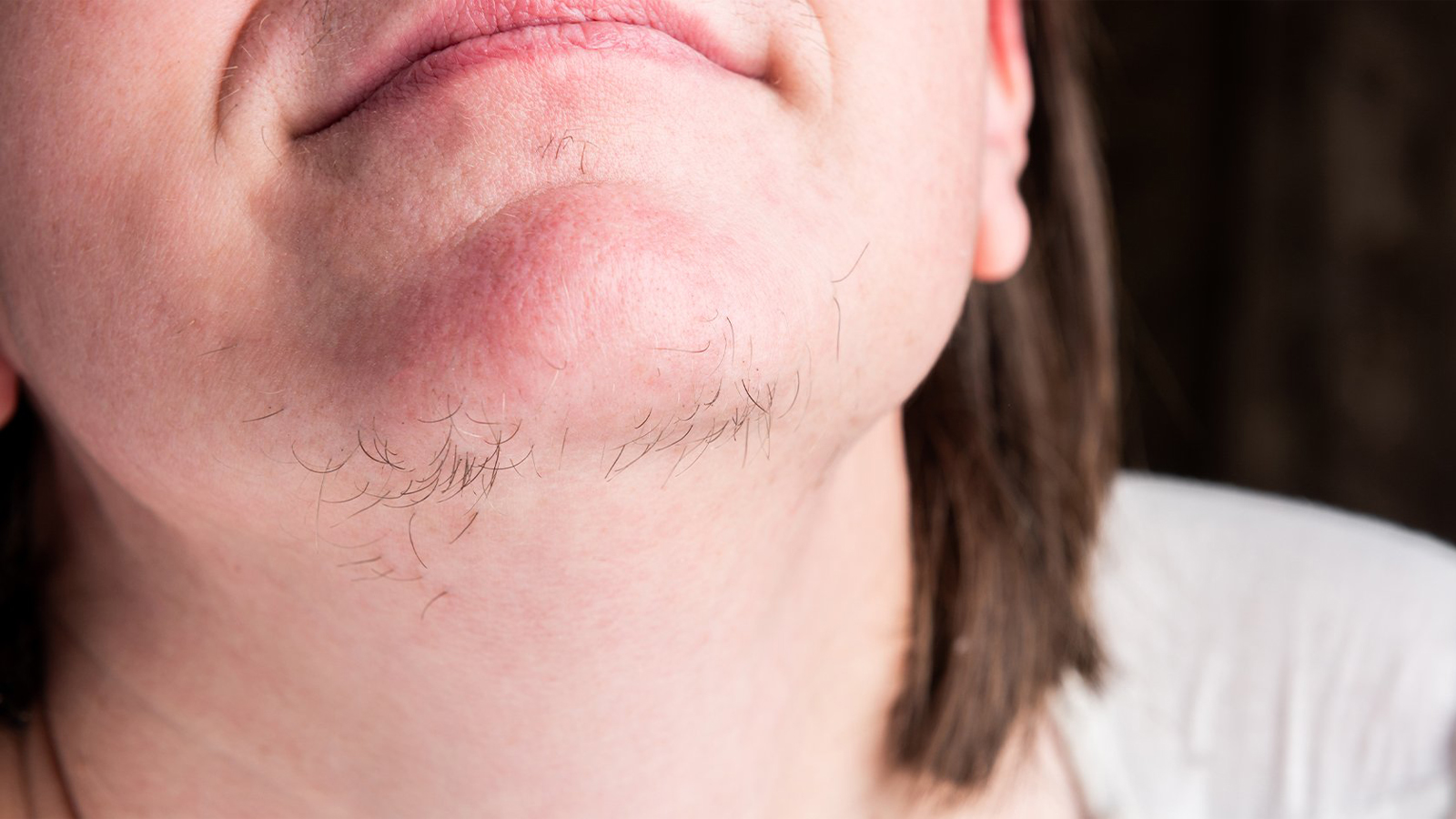 اصلی‌ترین عامل رشد موهای زائد