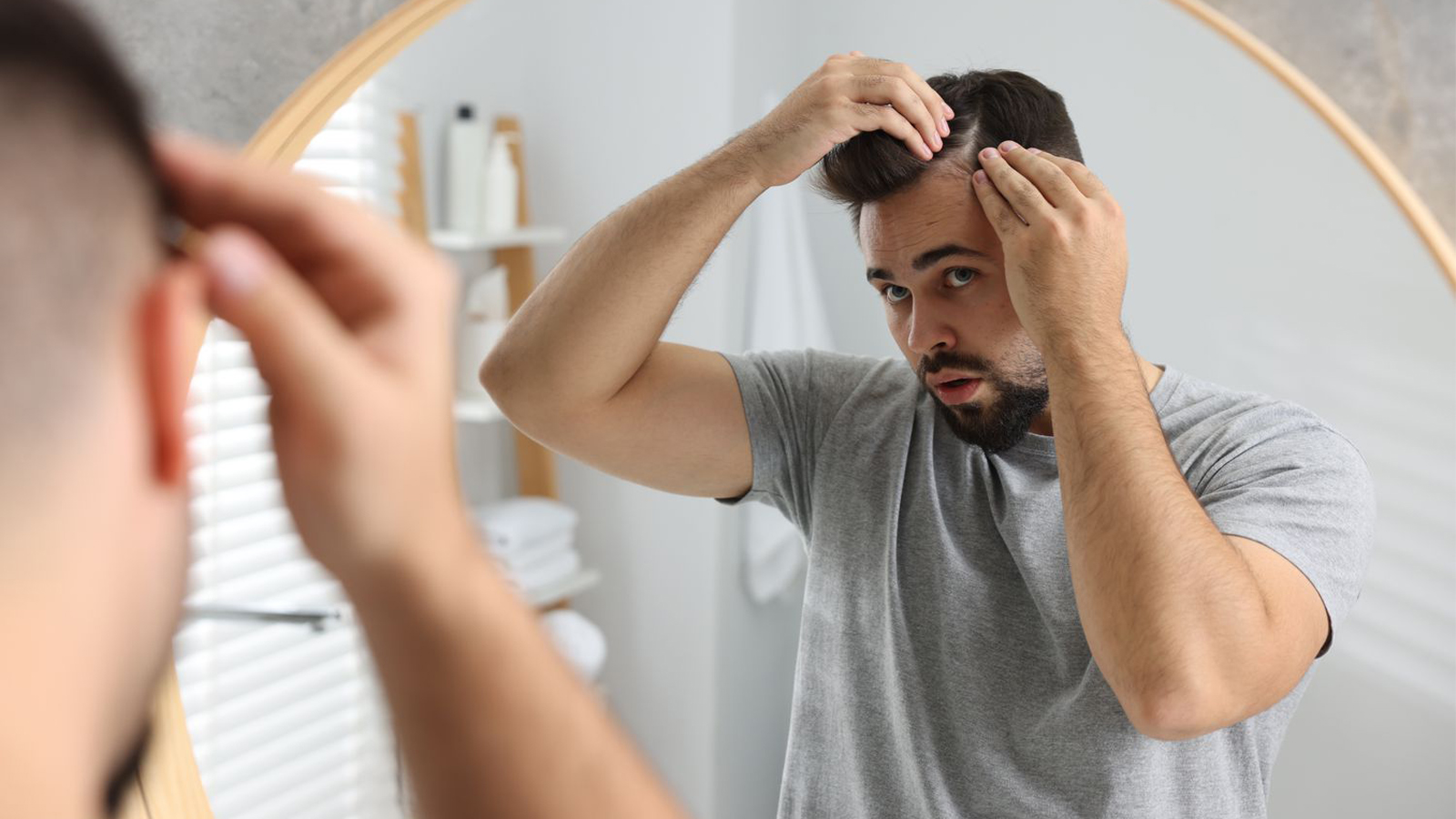 سفید شدن زودرس مو