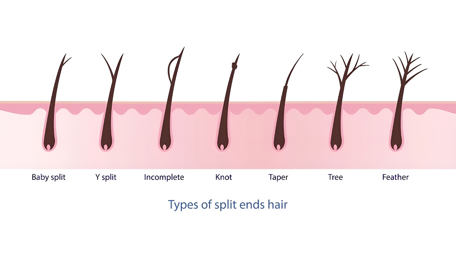 انواع موخوره