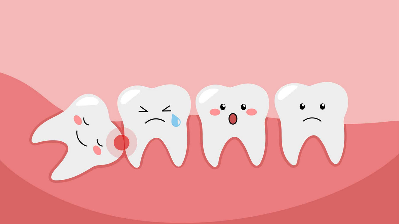 عفونت دندان عقل