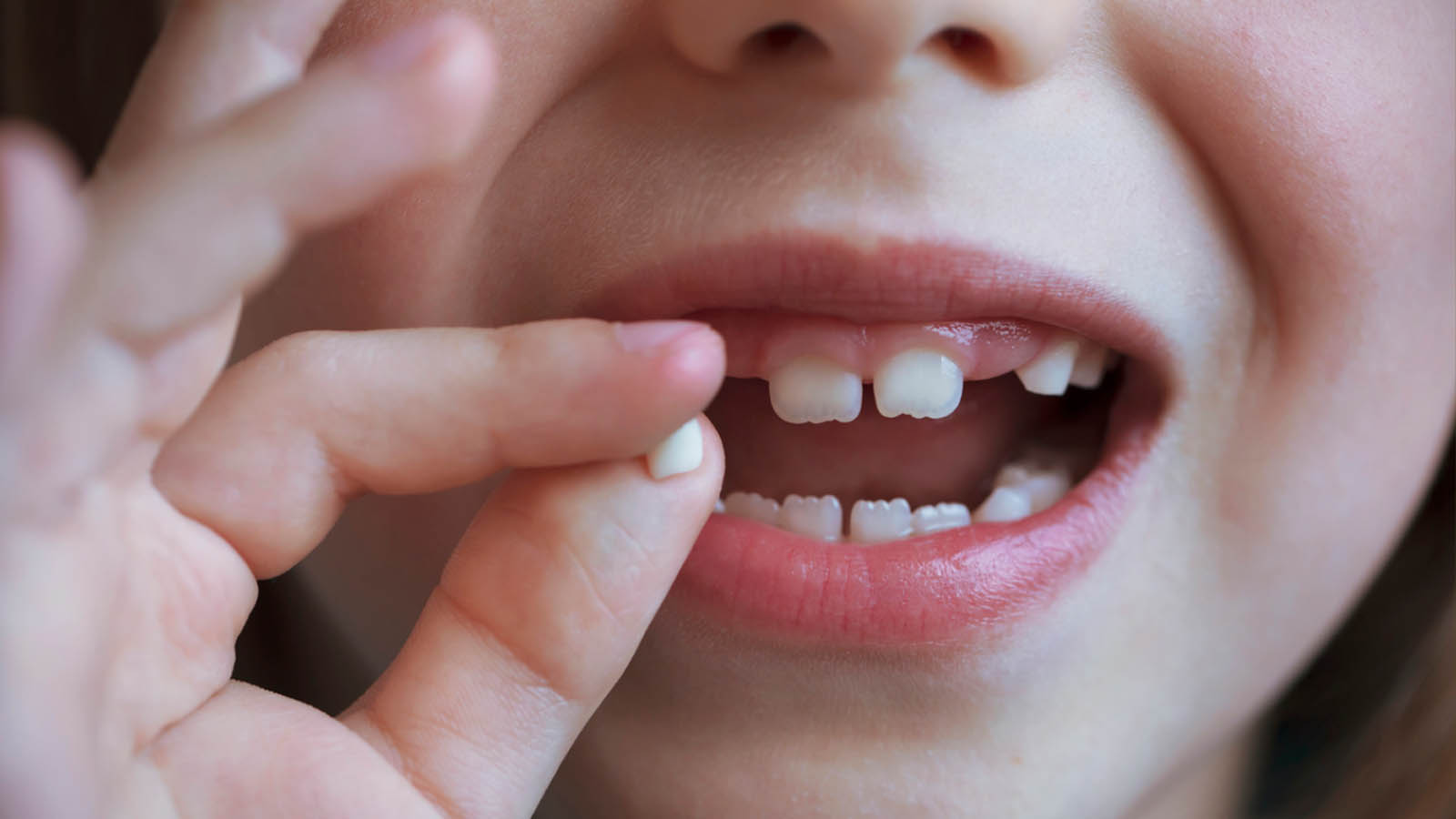 زمان افتادن دندان شیری