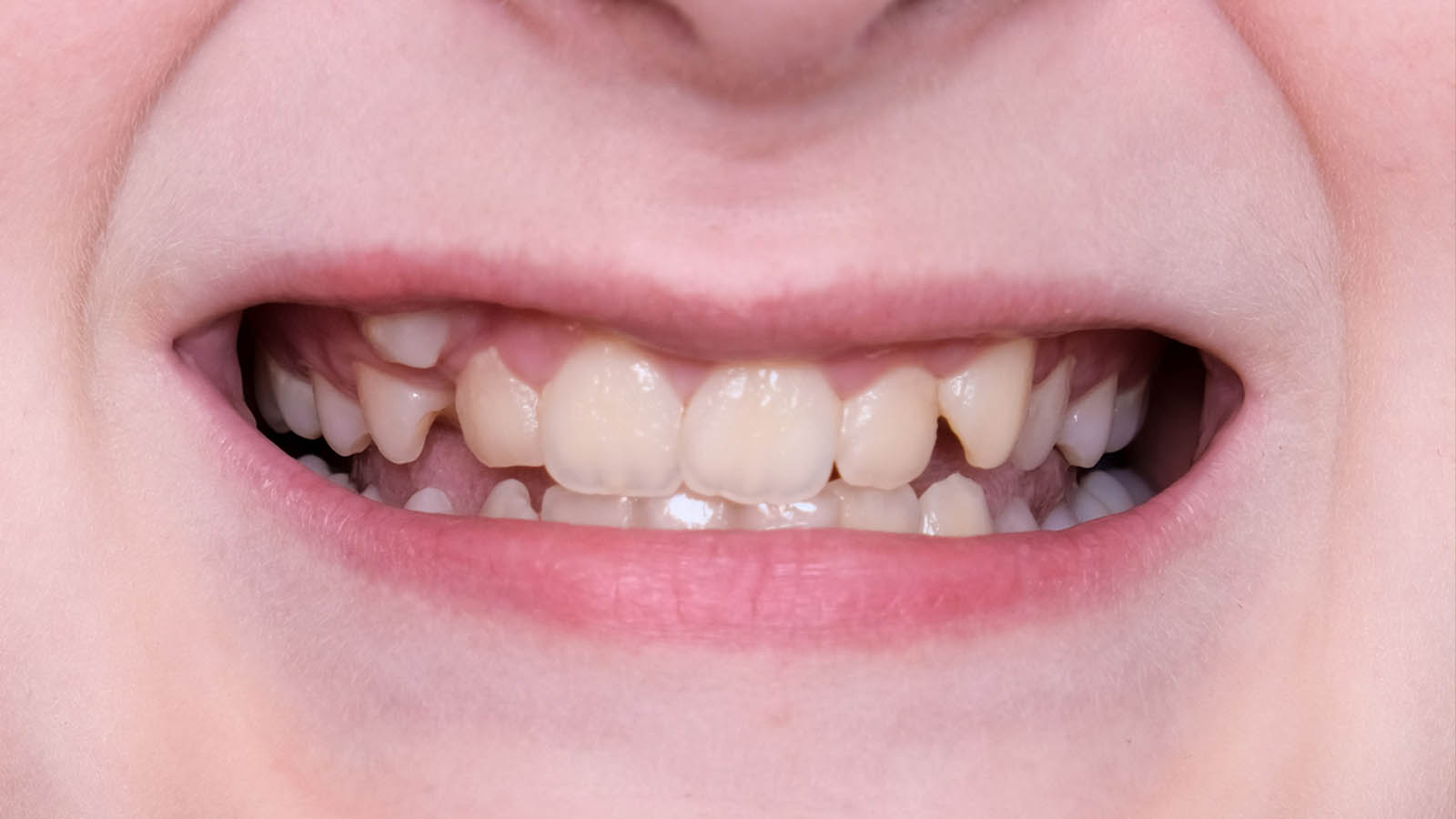 مسواک مناسب کودکان