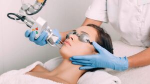 لیزر CO2 فرکشنال