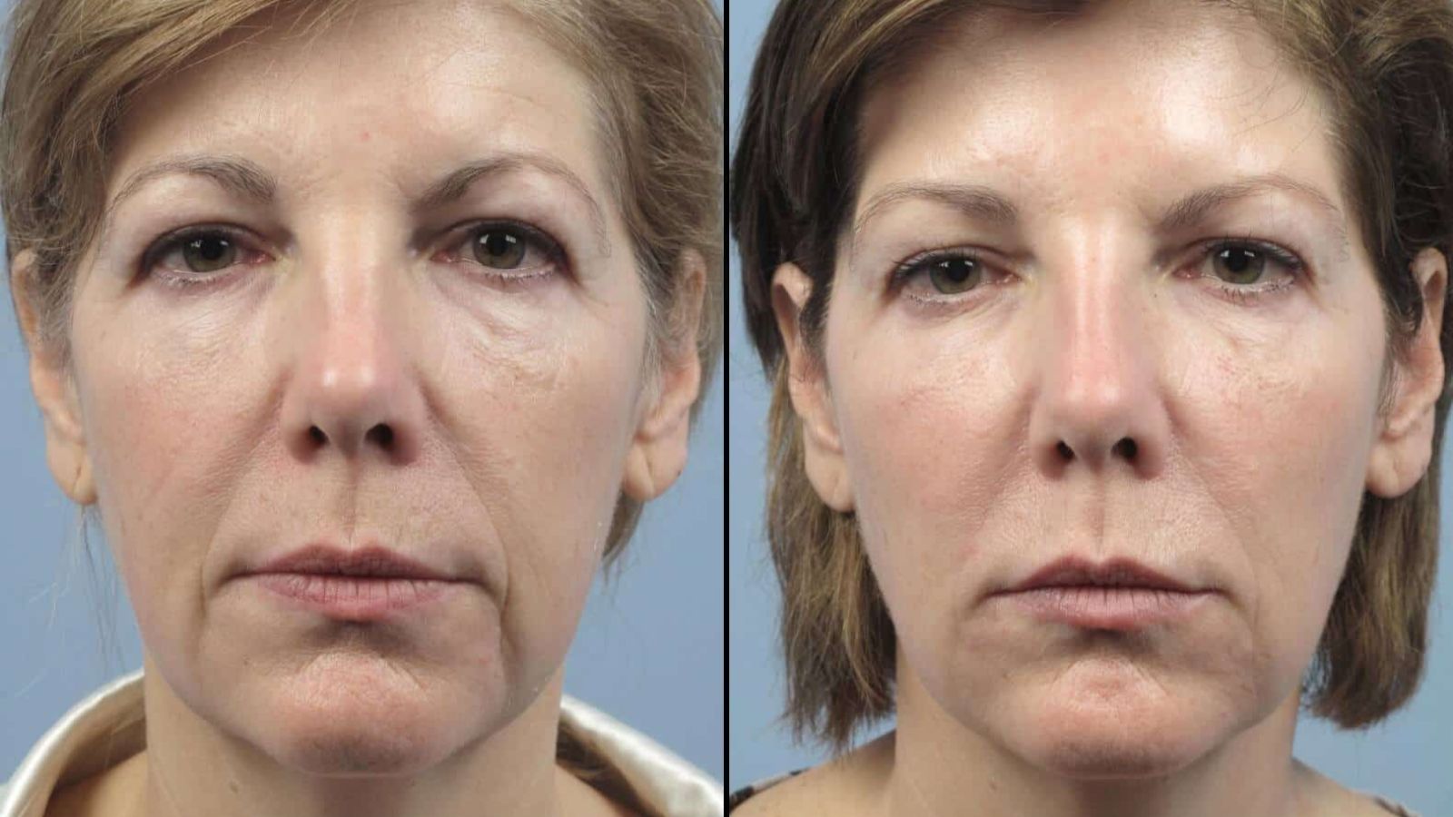 نمونه قبل و بعد