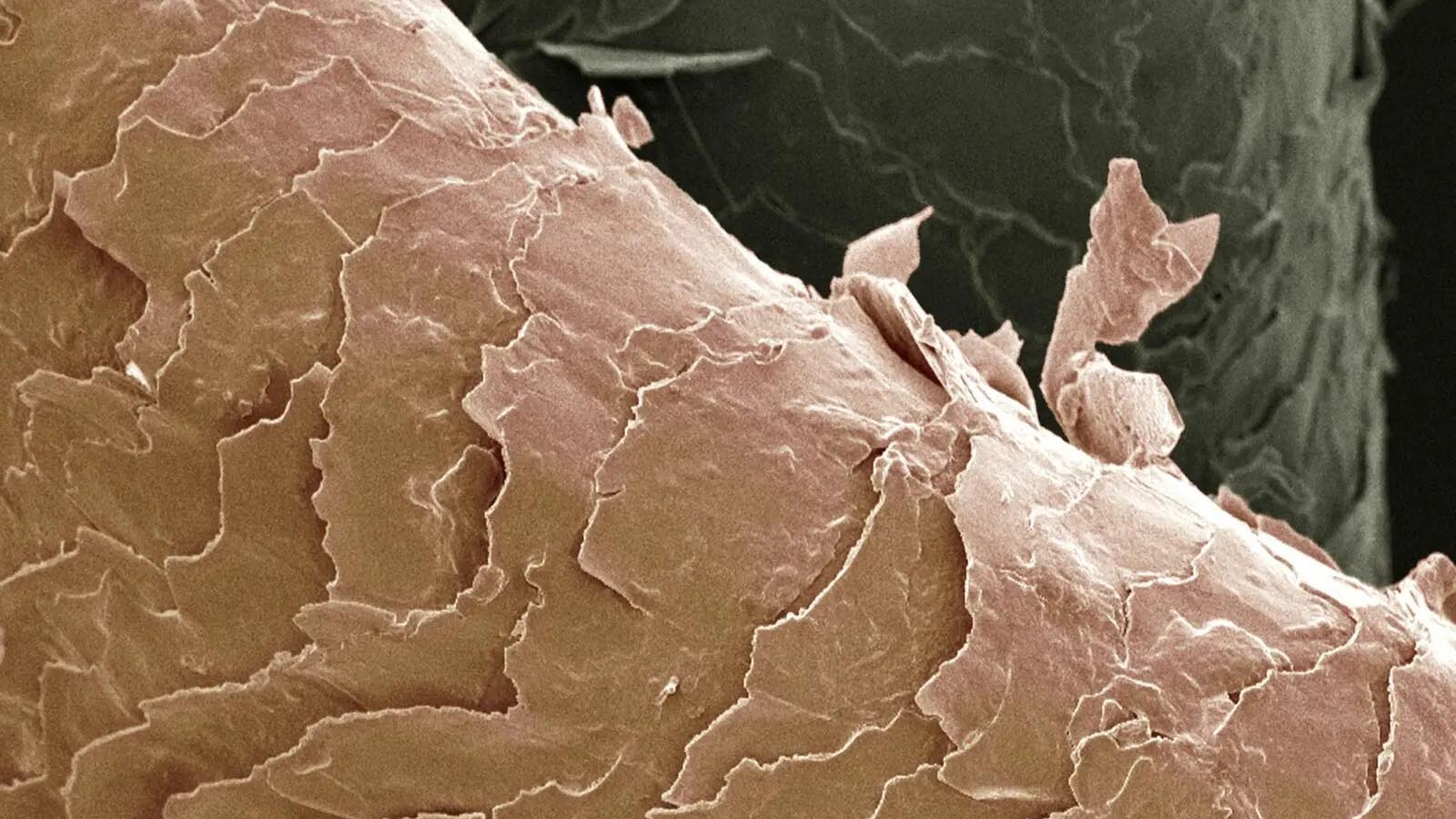 سرم محافظ حرارتی