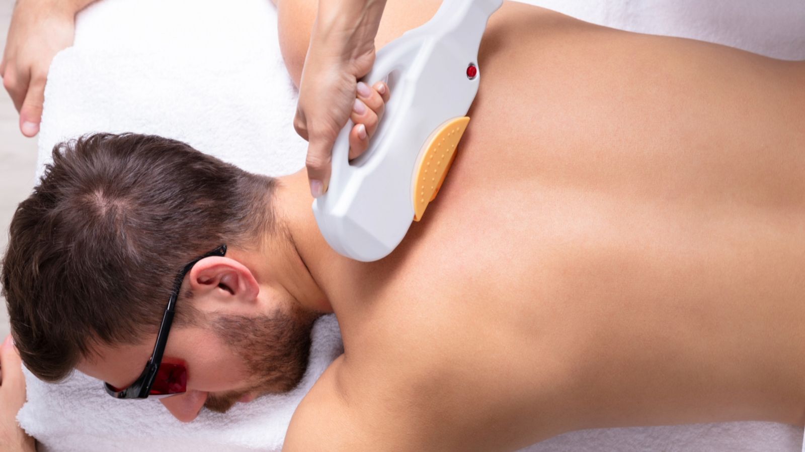 لیزر موهای زائد مردان