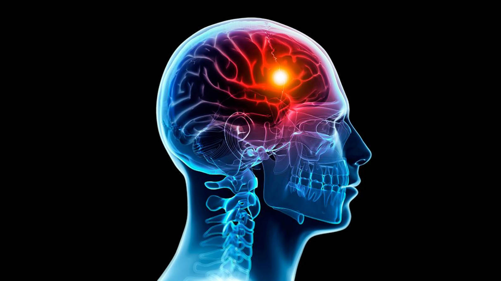 درد میگرن کجای سر است