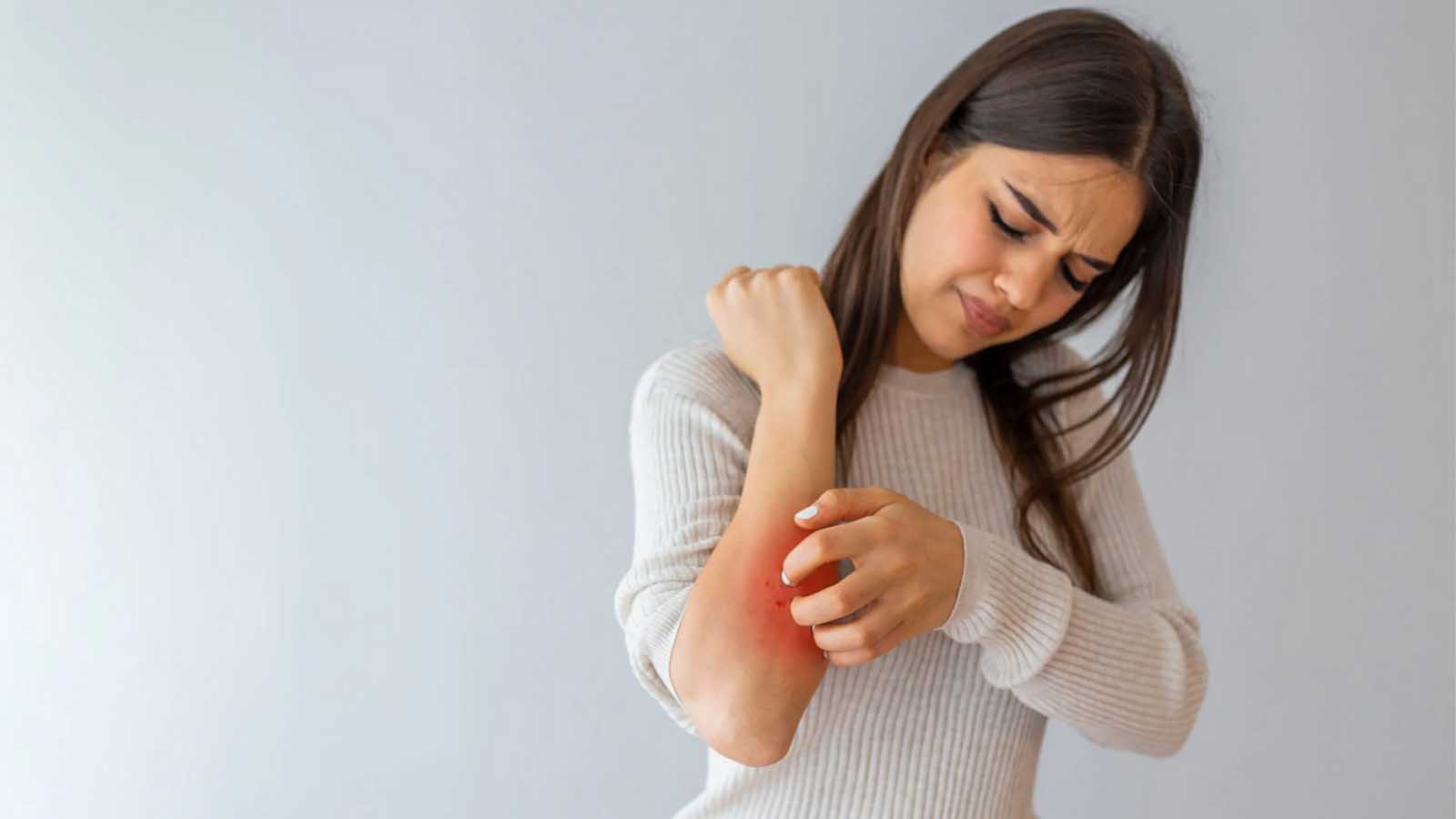 شکل ظاهری قارچ پوستی