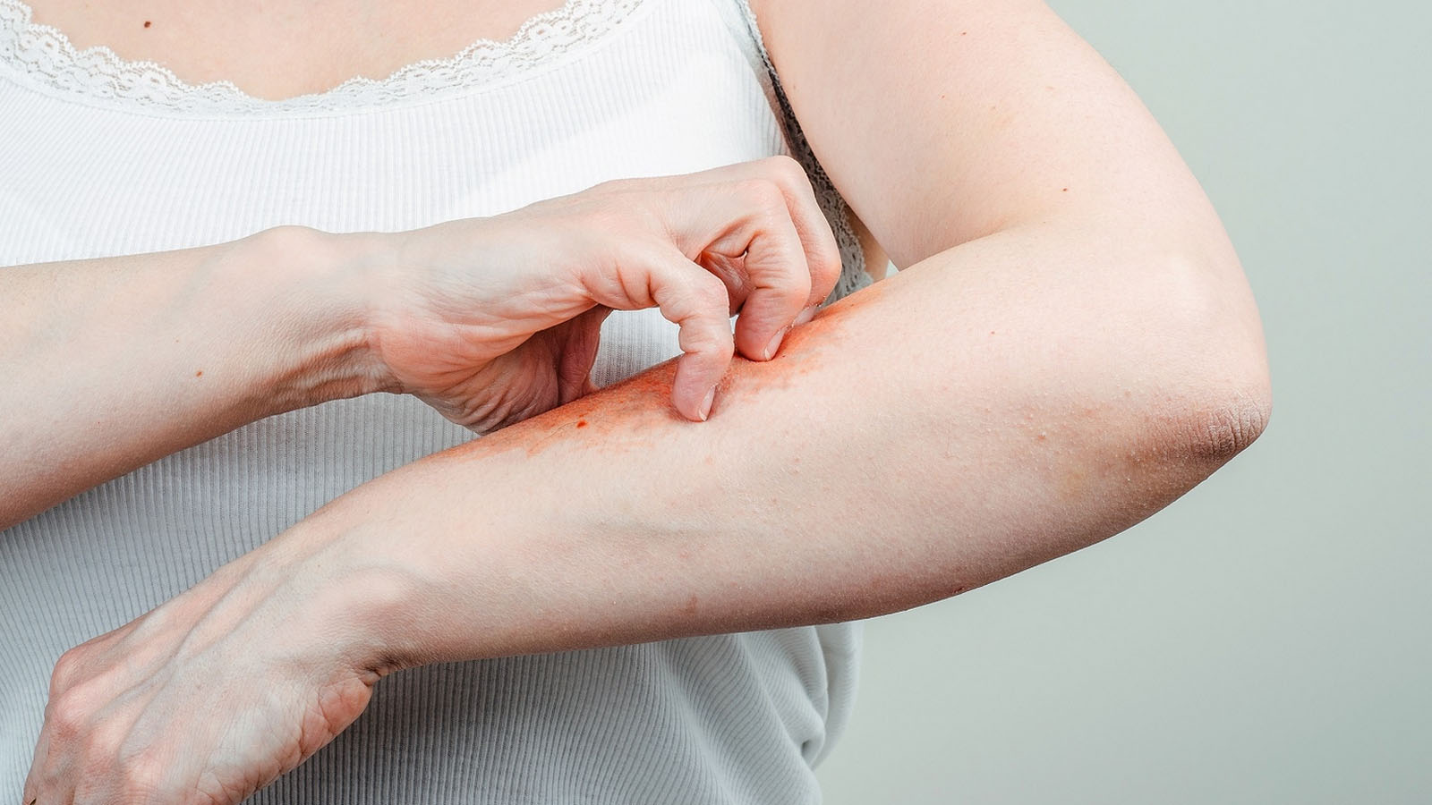 بیماری پوستی خطرناک