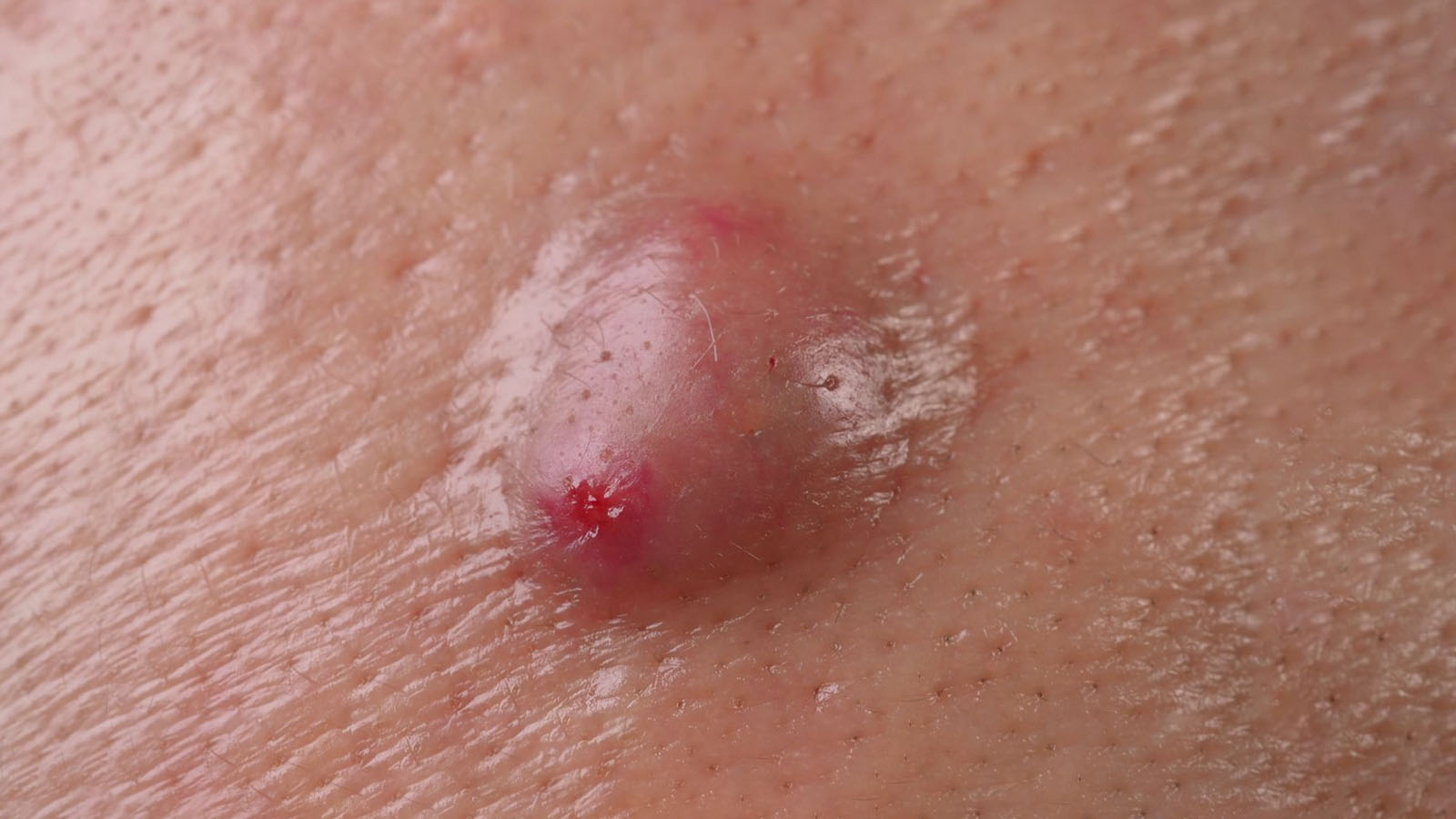 اسم بیماری های پوستی