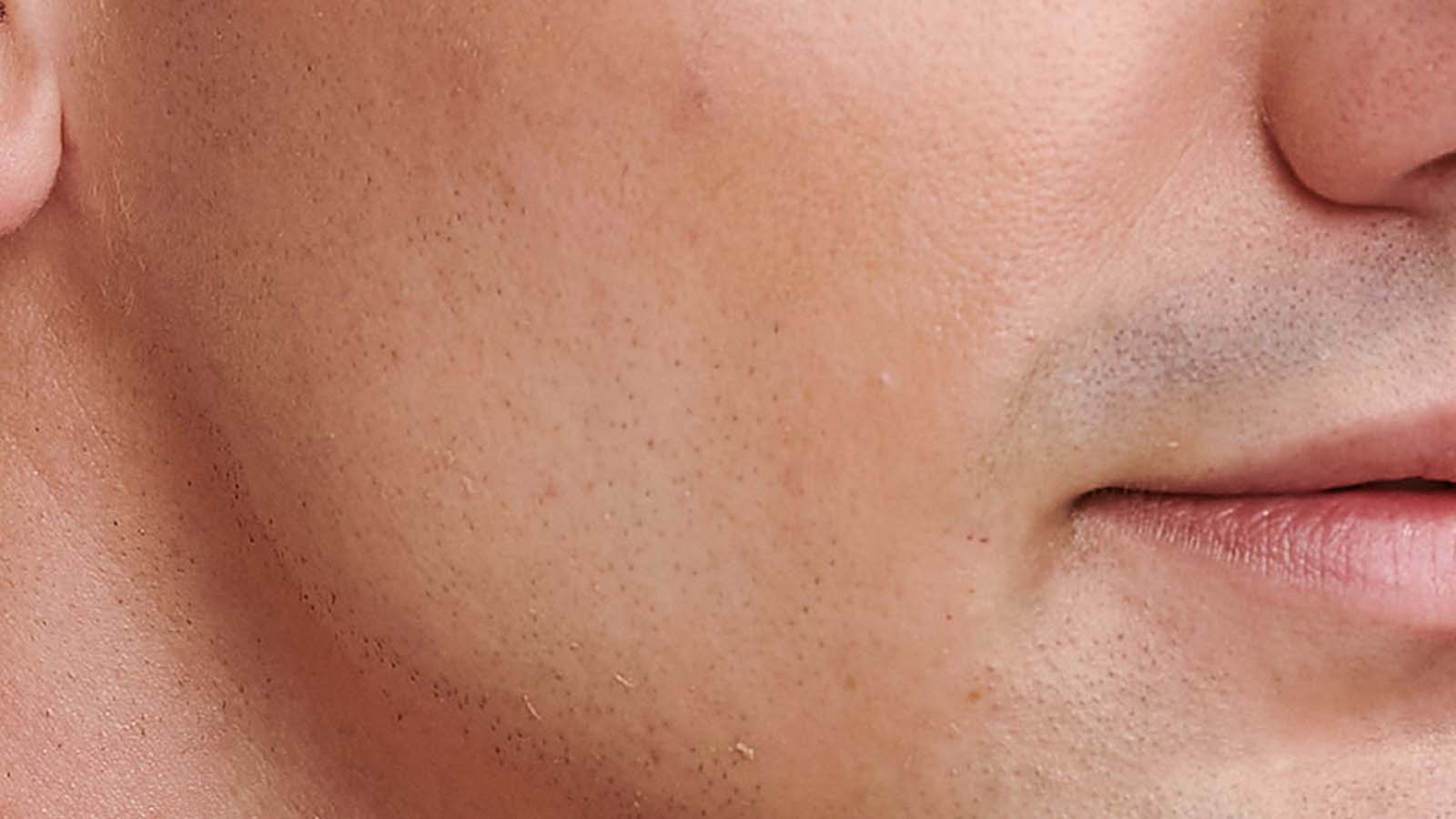 انواع پوست صورت