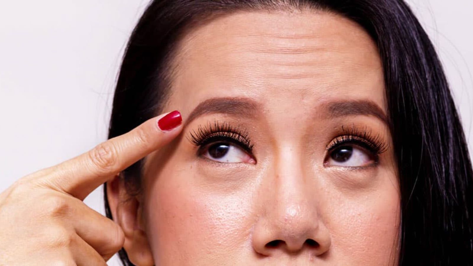 واکنش آلرژیک به بوتاکس