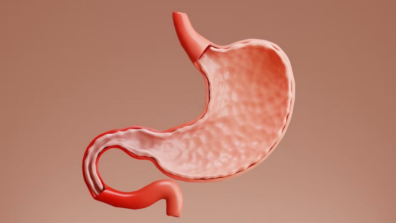 عکس ورم معده در آندوسکوپی