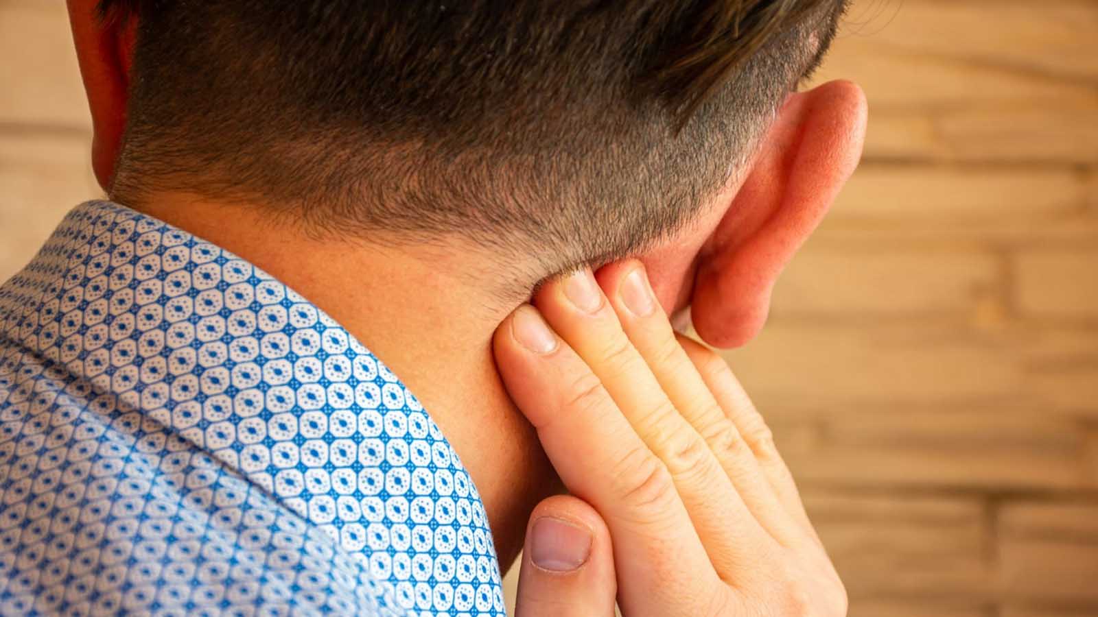 جوش های چرکی پشت گوش