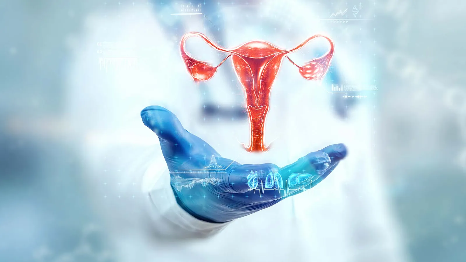 سندروم تخمدان کیست ساز