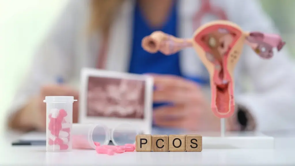سندروم تخمدان پلی کیستیک (PCOS)