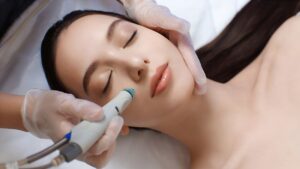 الکترولیز موهای زائد