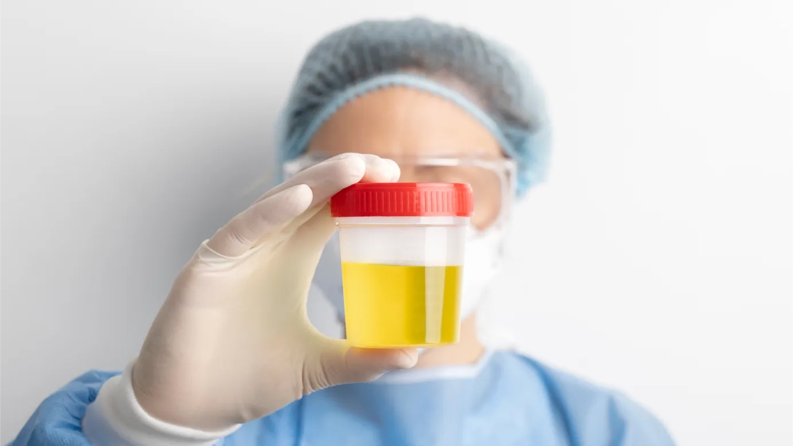 راه‌های تشخیص سنگ کلیه