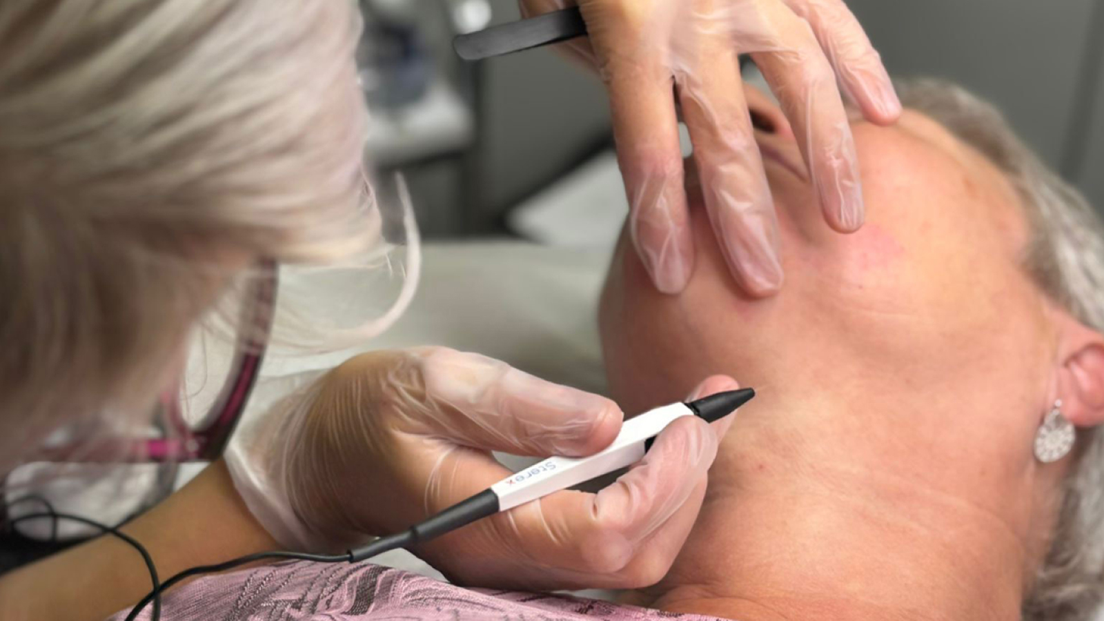 انواع الکترولیزر