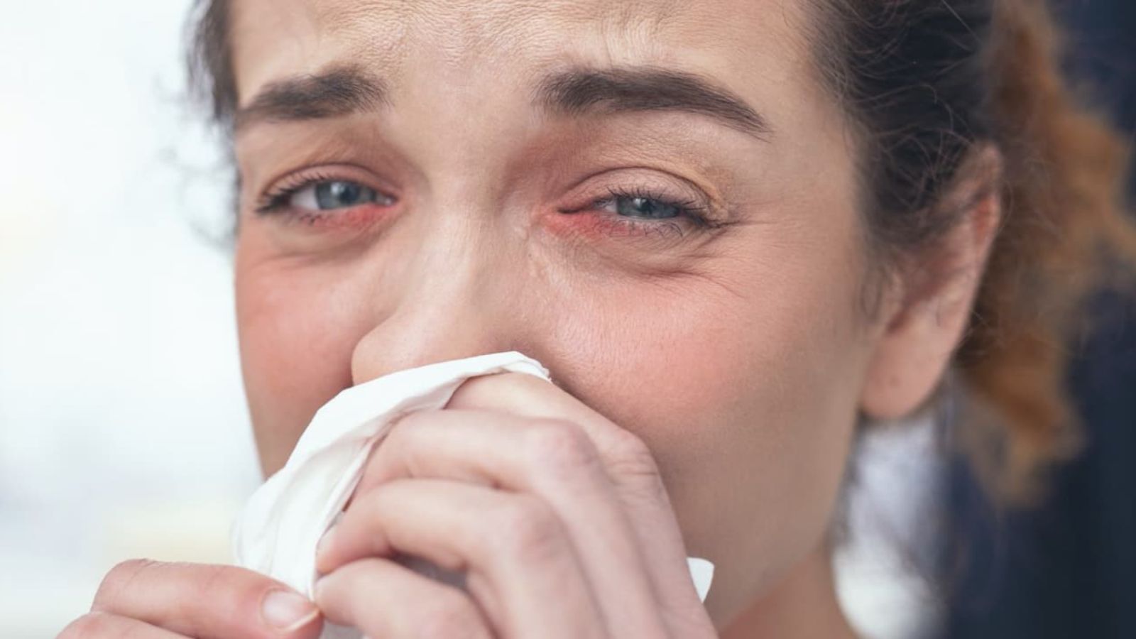 رینیت آلرژیک