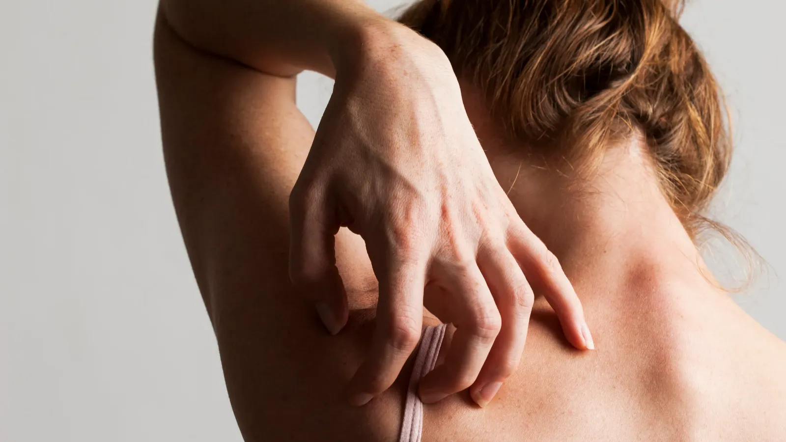 واکنش آلرژیک