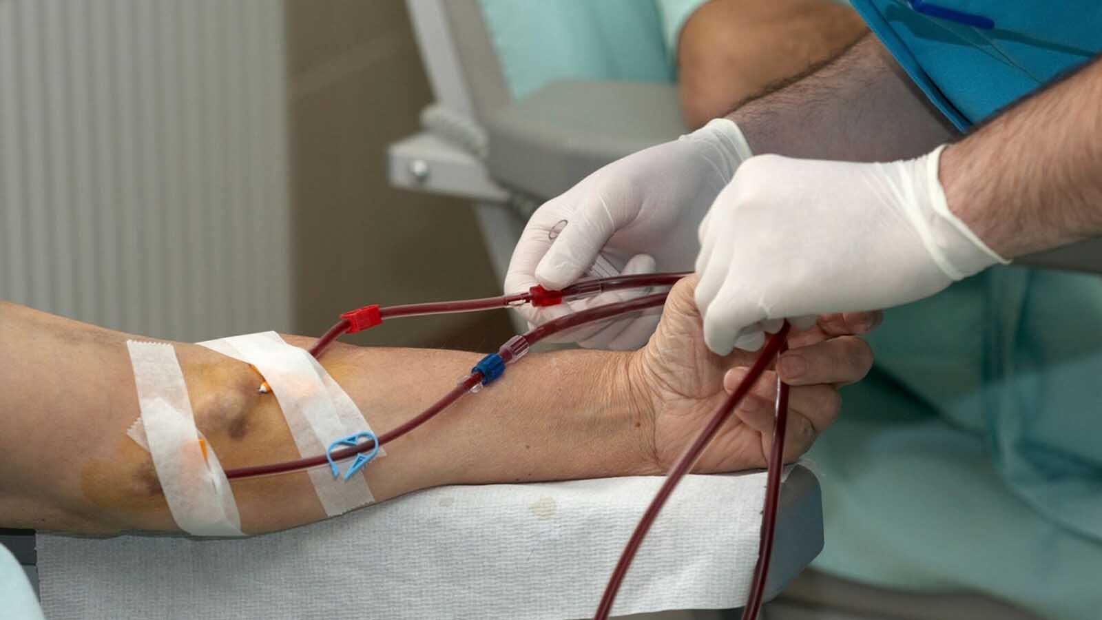 دیالیز و مرگ