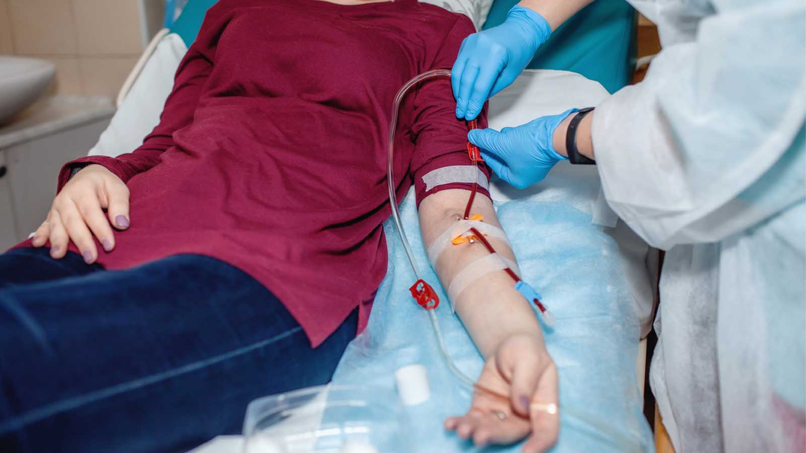 عکس دیالیز کلیه