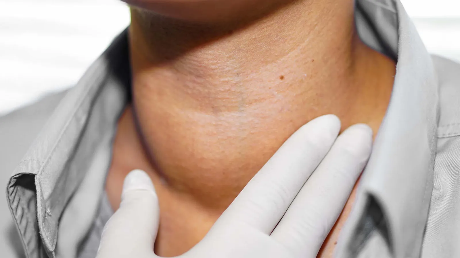 هل برای کم کاری تیروئید