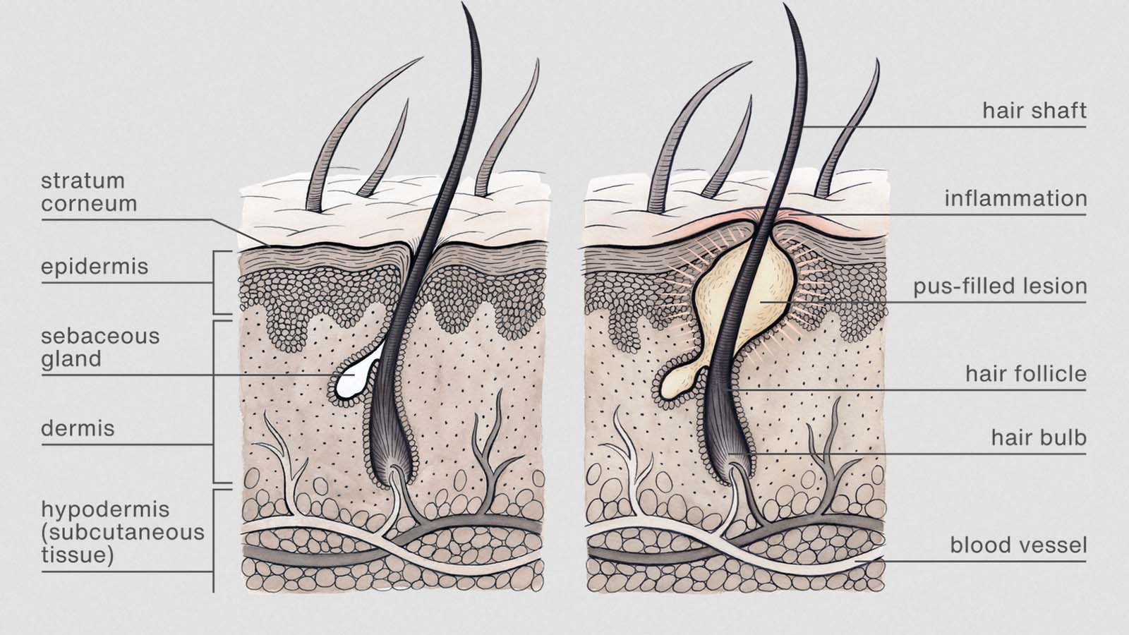 کورتکس مو چیه