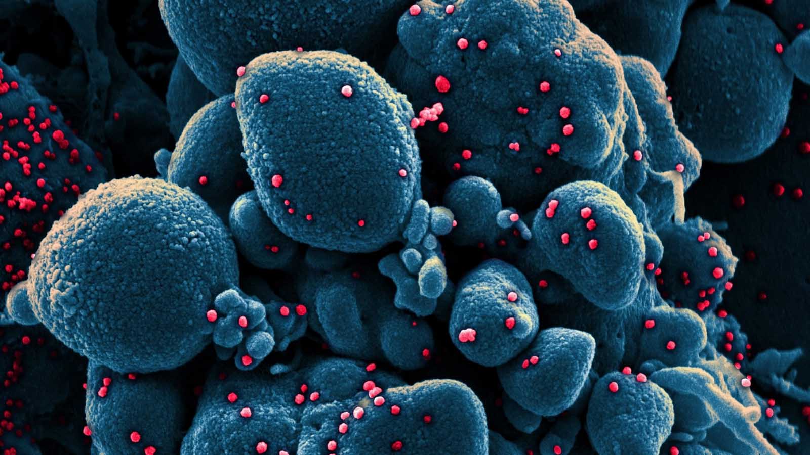 آنفولانزا اسپانیایی