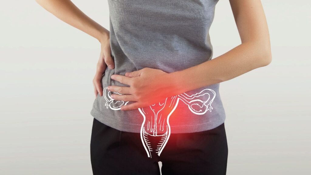 کیست تخمدان