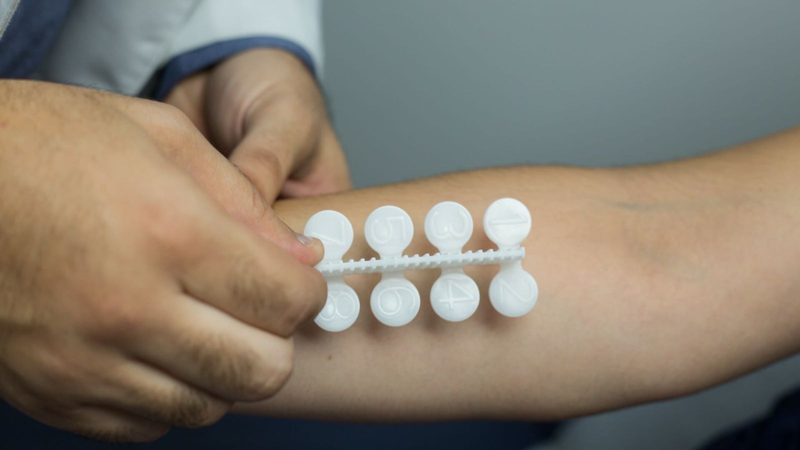 چه مواد غذایی آلرژی زا هستند