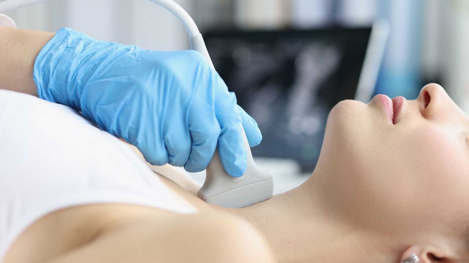 حد نرمال تیروئید