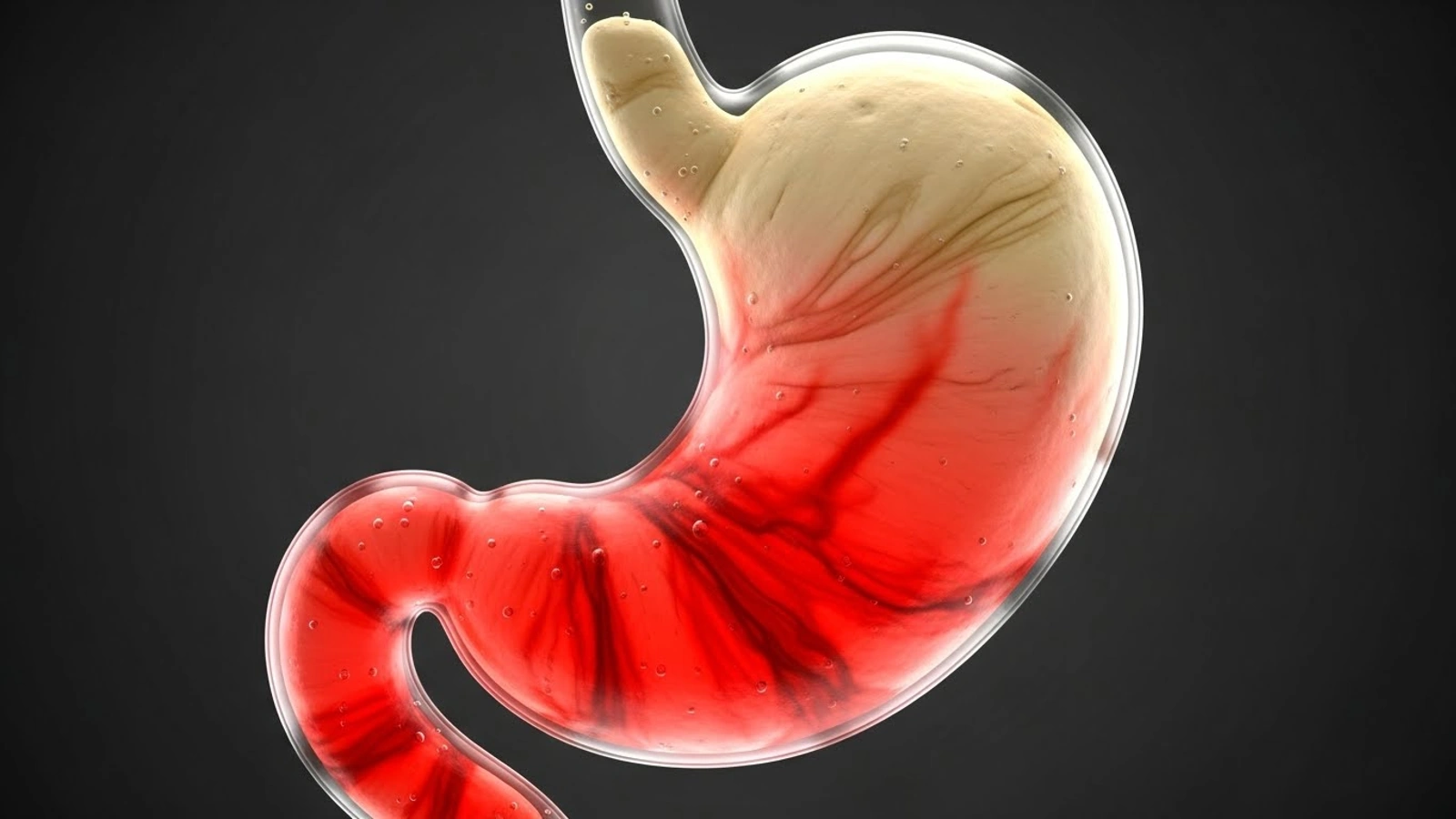 برهم خوردن تعادل گوارشی