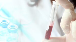 کاتکول آمین چیست و آزمایش آن به چه دلیل انجام می‌شود؟