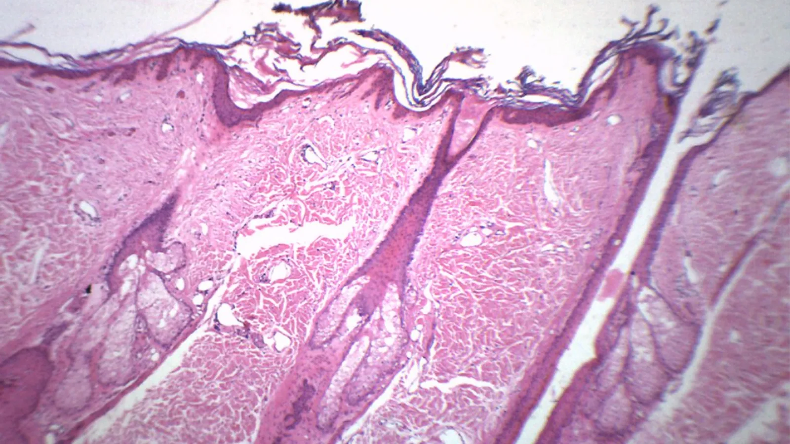 ساختمان ساقه مو