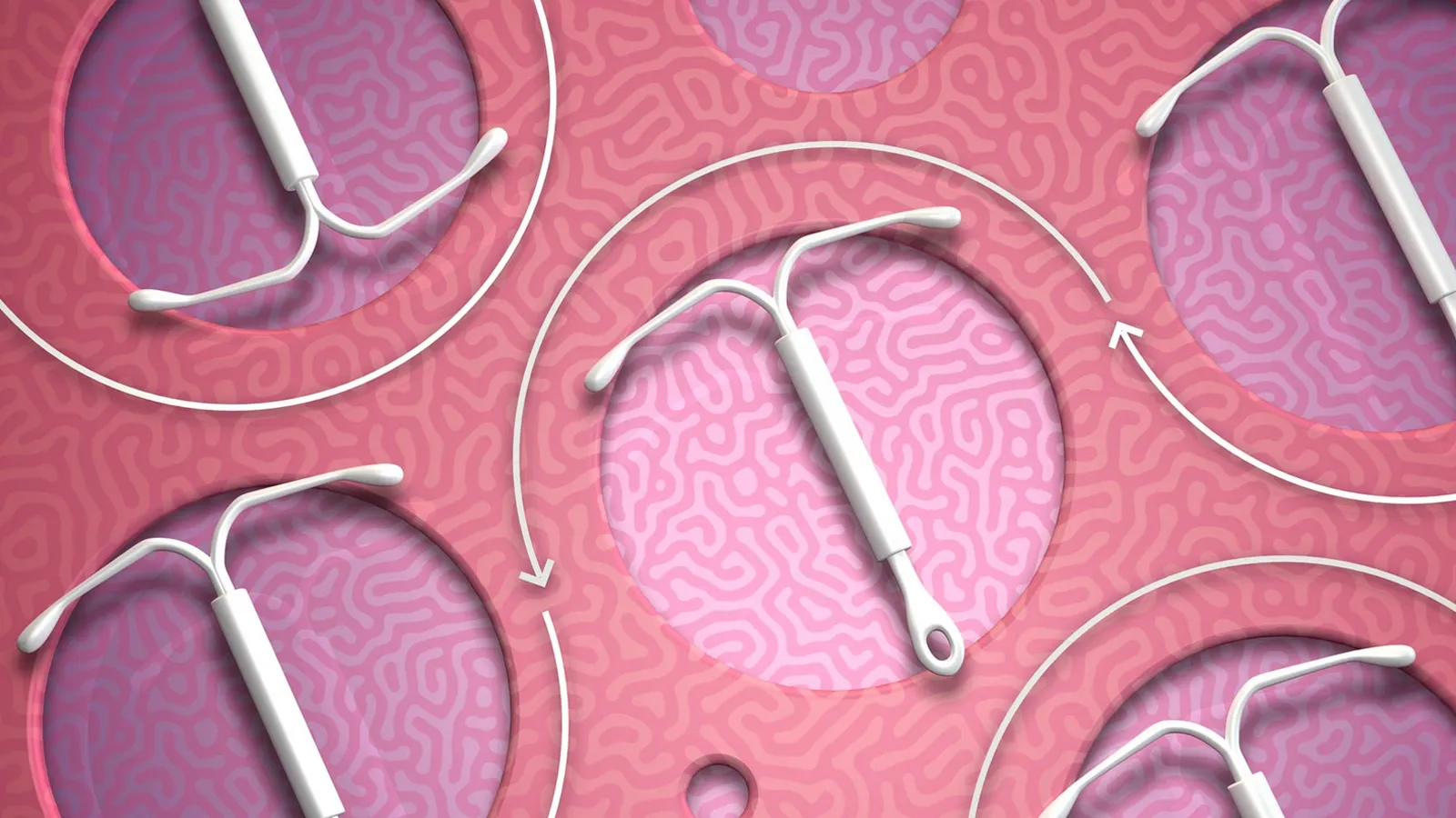 فیلم برداشتن آیودی بدون نخ