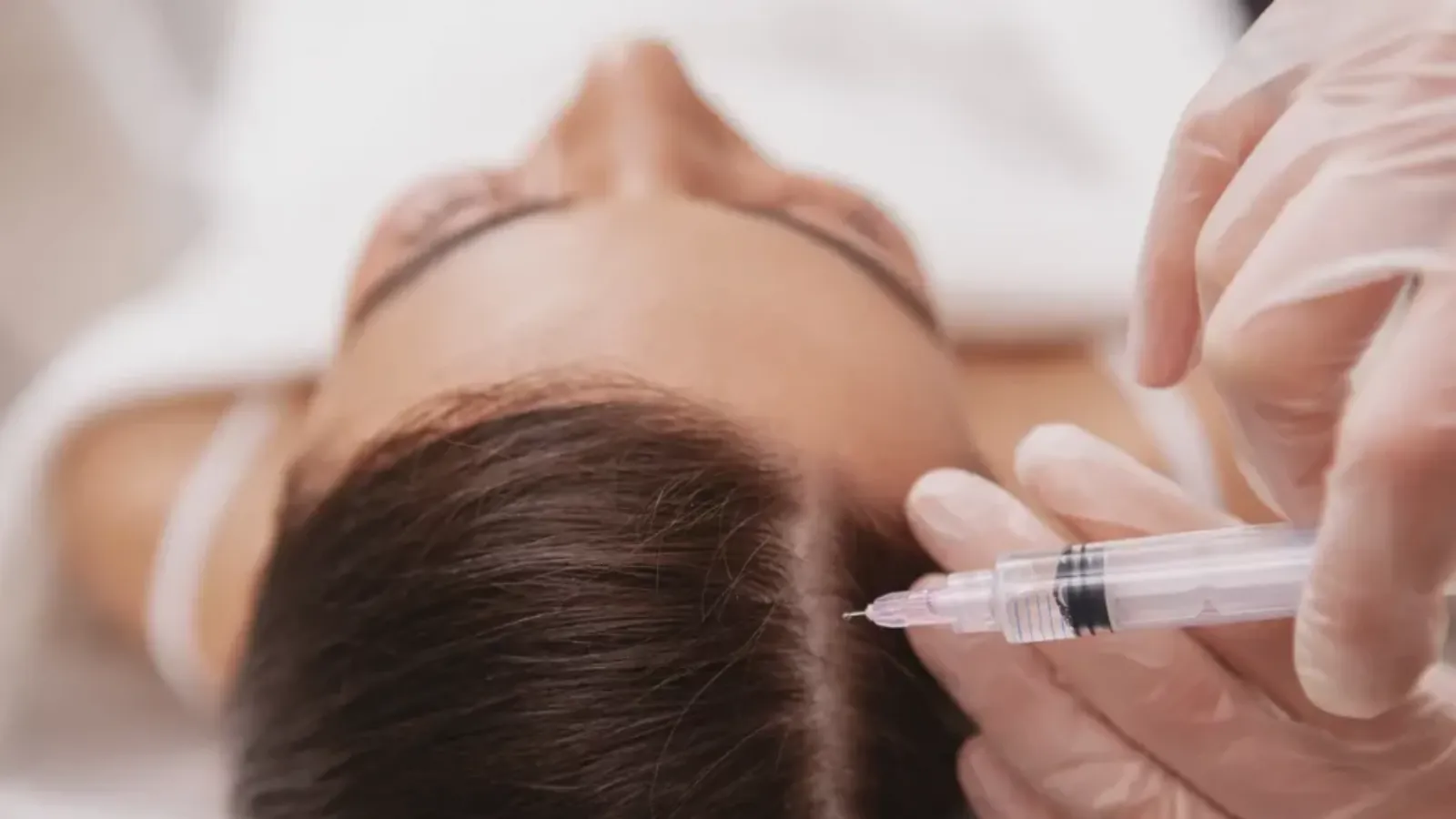 مراقبت بعد از پی آر پی مو: جلسات تکراری و اهمیت پیگیری پزشکی