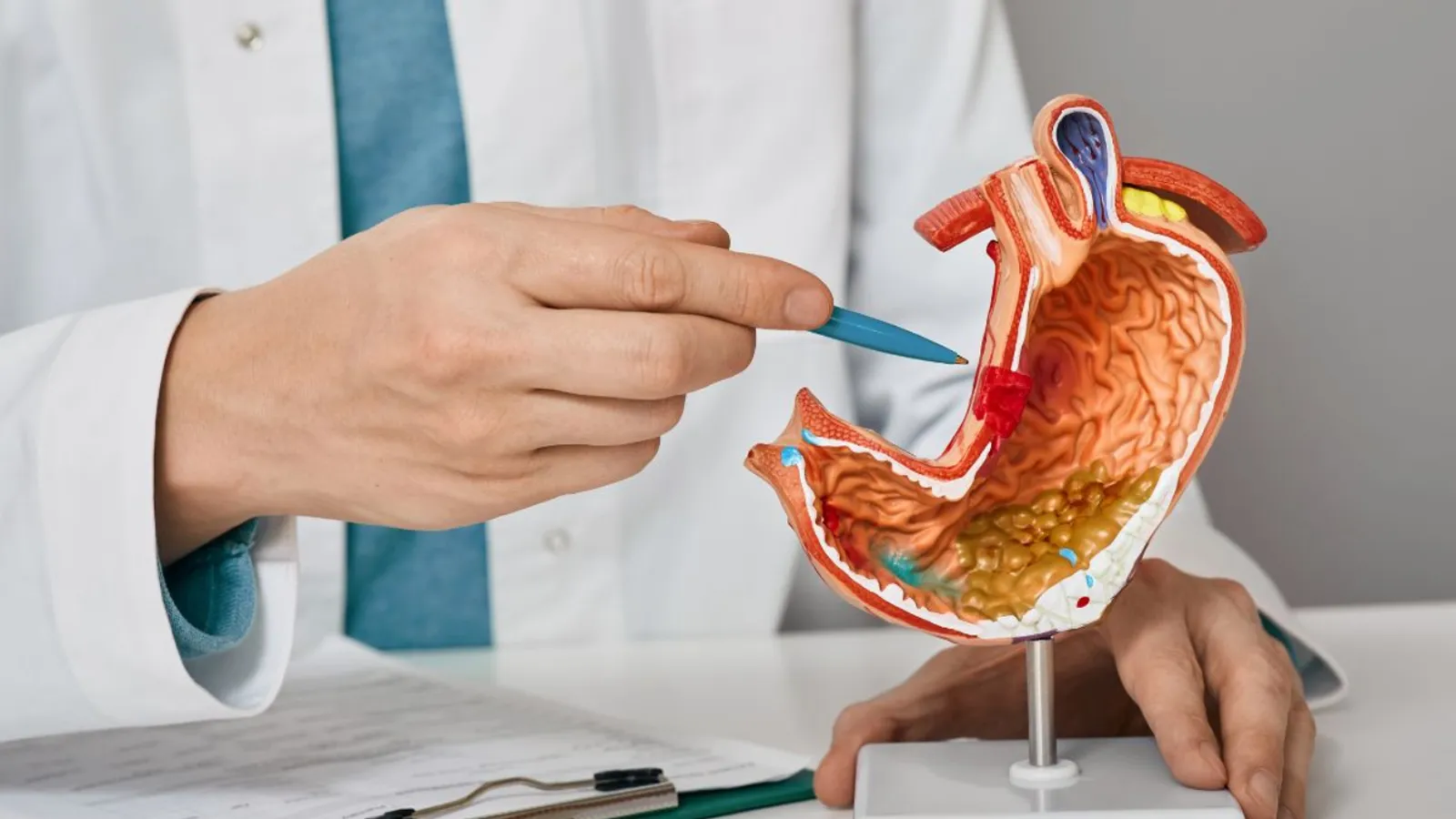 ایا عمل زخم معده خطرناک است