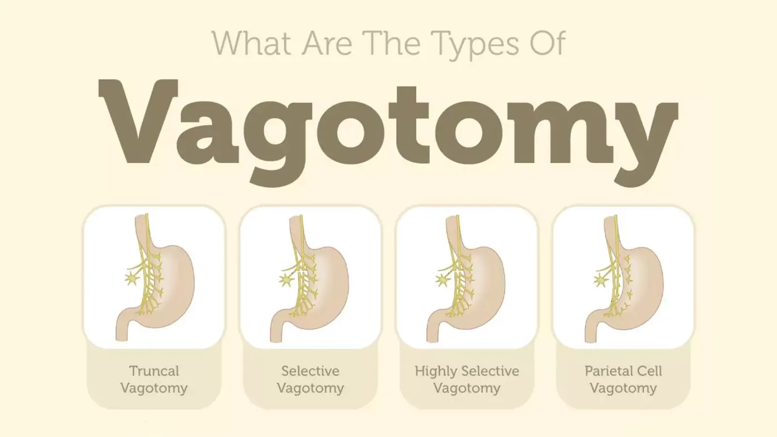 رژیم غذایی بعد از عمل زخم معده