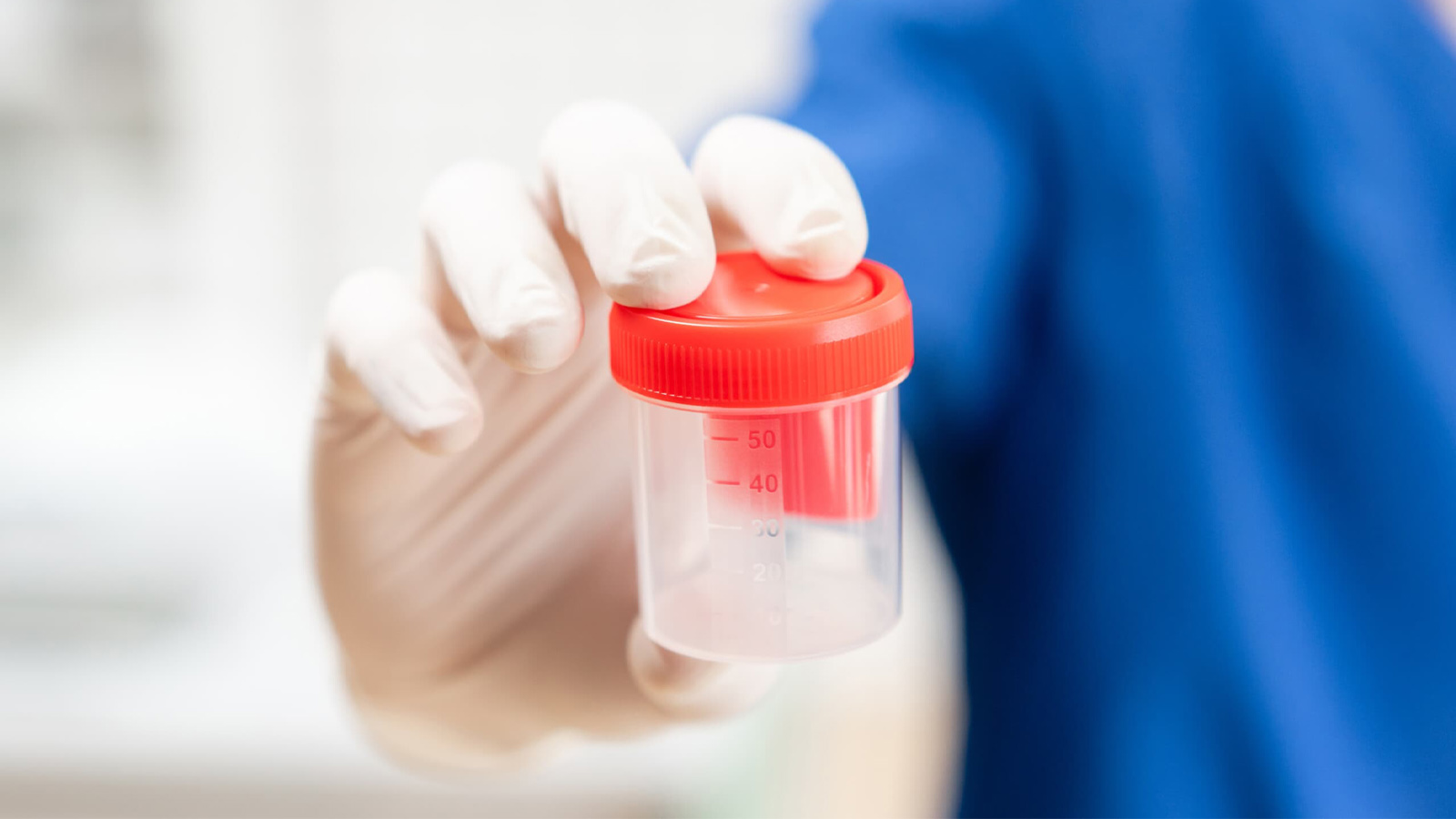 تشخیص کم تحرکی اسپرم