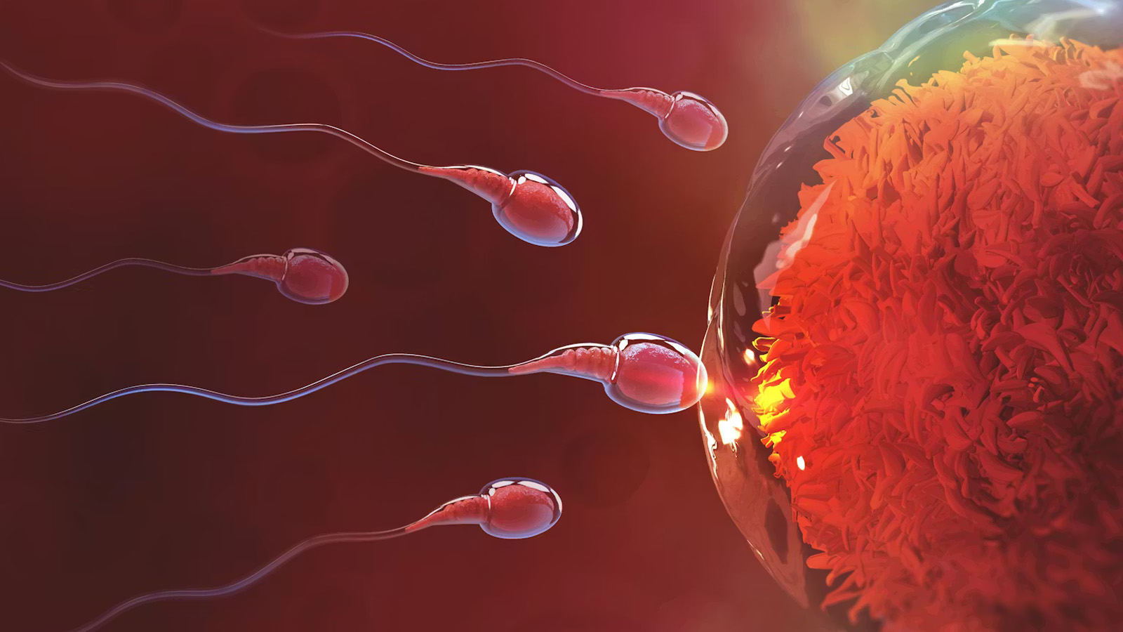 واریکوسل و کم‌تحرکی اسپرم