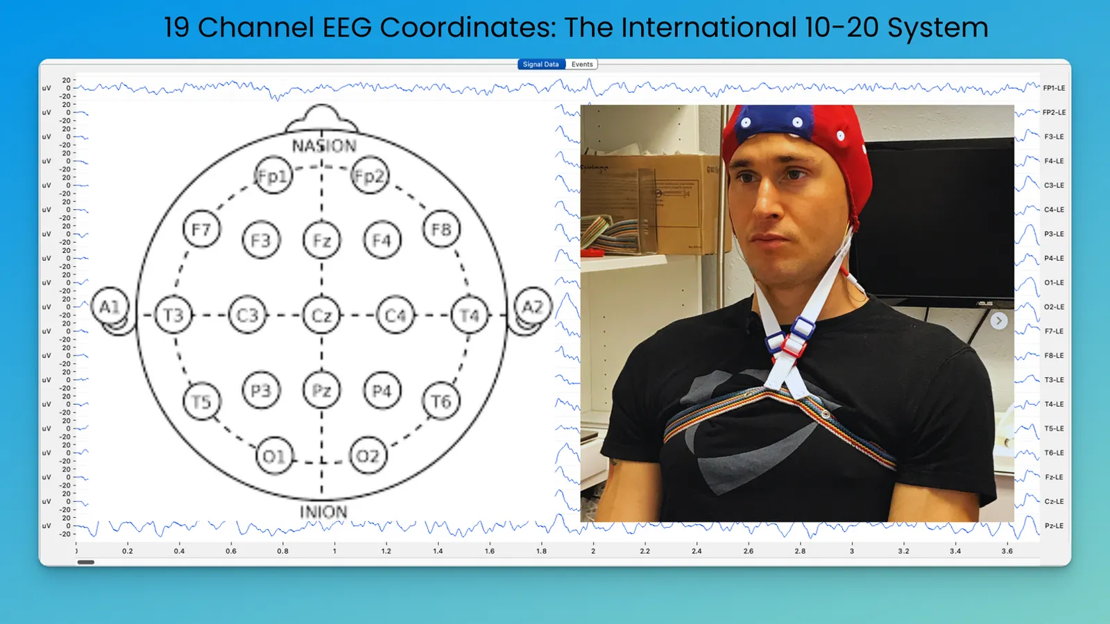 علائم اوتیسم سطح یک