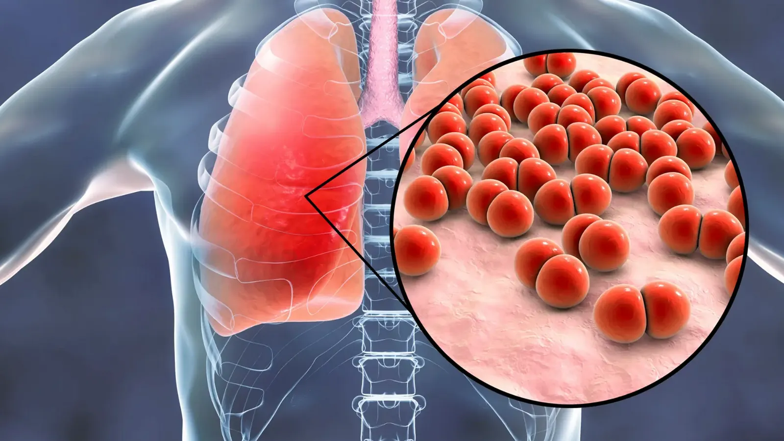 آلودگی هوا باعث چه بیماری هایی می شود