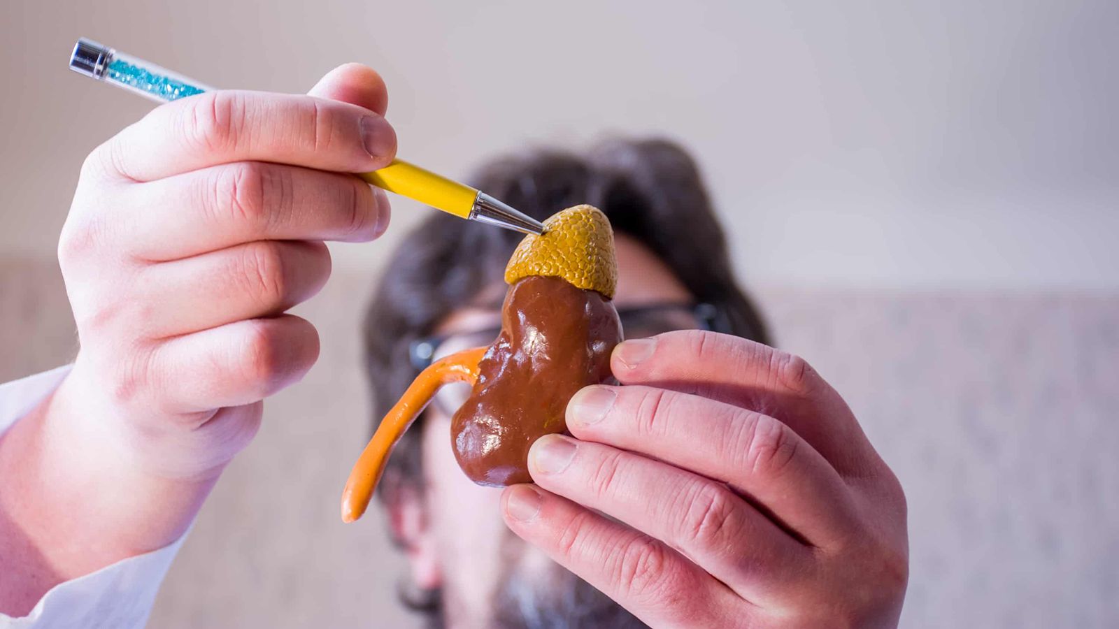 فئوکروموسیتوما