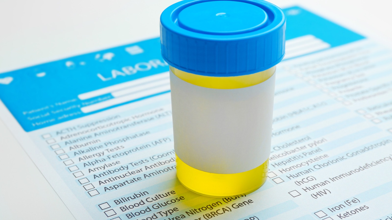 24 hour urine collection