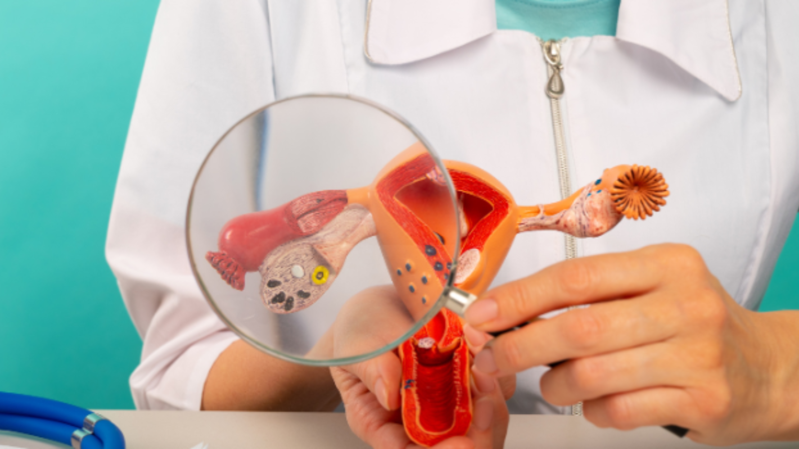 خواص اذخر برای کیست تخمدان و رحم